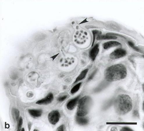 The chytrid, a pathogenic fungus