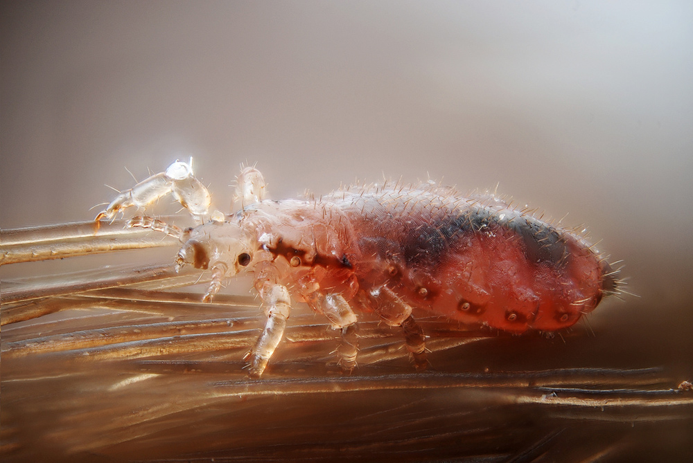Head lice | Space for life